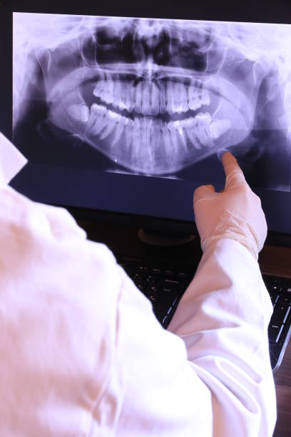 Best Emergency Wisdom Tooth Extraction in Vail, CO